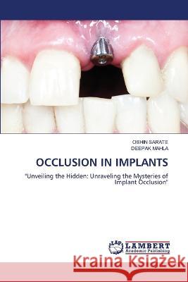 OCCLUSION IN IMPLANTS SARATE, OSHIN, MAHLA, DEEPAK 9786206164630 LAP Lambert Academic Publishing - książka