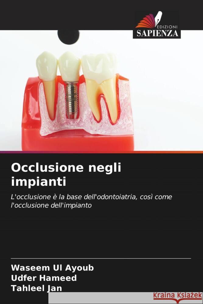 Occlusione negli impianti Ul Ayoub, Waseem, Hameed, Udfer, Jan, Tahleel 9786204641881 Edizioni Sapienza - książka