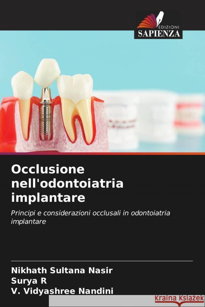 Occlusione nell'odontoiatria implantare Sultana Nasir, Nikhath, R, Surya, Nandini, V. Vidyashree 9786204767420 Edizioni Sapienza - książka