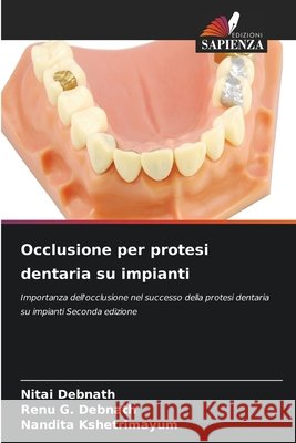 Occlusione per protesi dentaria su impianti Nitai Debnath Renu G. Debnath Nandita Kshetrimayum 9786630081343 Edizioni Sapienza - książka