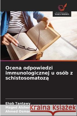 Ocena odpowiedzi immunologicznej u osób z schistosomatoza Tantawy, Ehab, Alsherbiny, Maged, Osman, Ahmed 9786206827283 Wydawnictwo Nasza Wiedza - książka