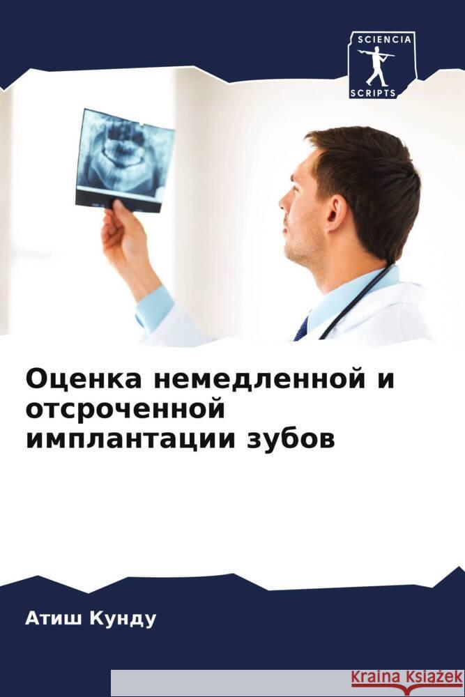 Ocenka nemedlennoj i otsrochennoj implantacii zubow Kundu, Atish 9786207096060 Sciencia Scripts - książka