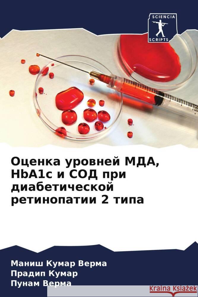 Ocenka urownej MDA, HbA1c i SOD pri diabeticheskoj retinopatii 2 tipa Verma, Manish Kumar, Kumar, Pradip, Verma, Punam 9786207107070 Sciencia Scripts - książka