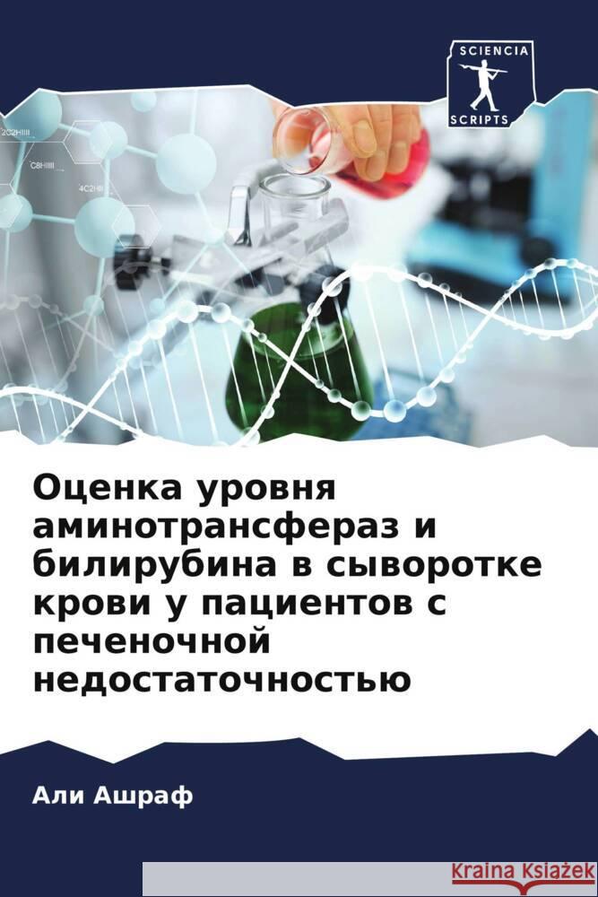 Ocenka urownq aminotransferaz i bilirubina w syworotke krowi u pacientow s pechenochnoj nedostatochnost'ü Ashraf, Ali 9786208105761 Sciencia Scripts - książka