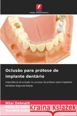 Oclus?o para pr?tese de implante dent?rio Nitai Debnath Renu G. Debnath Nandita Kshetrimayum 9786630091588 Edicoes Nosso Conhecimento - książka