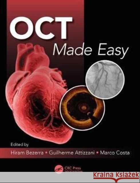 Oct Made Easy Guilherme F. Attizzani Guilherme F. Attizzani Hiram G. Bezerra 9781498714563 CRC Press - książka