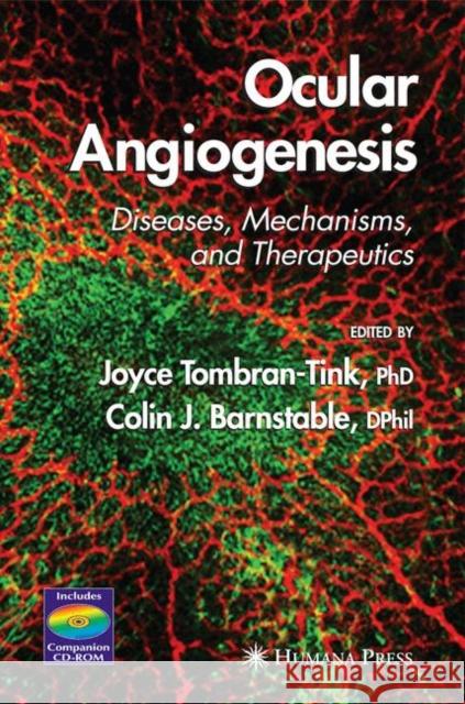 Ocular Angiogenesis: Diseases, Mechanisms, and Therapeutics Tombran-Tink, Joyce 9781588295149 Humana Press - książka