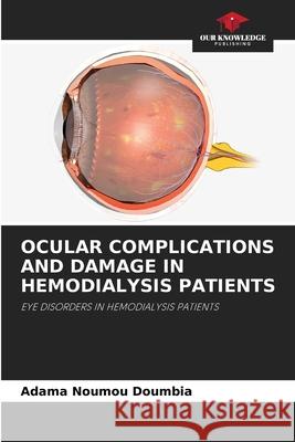 Ocular Complications and Damage in Hemodialysis Patients Adama Noumou Doumbia 9786207547005 Our Knowledge Publishing - książka