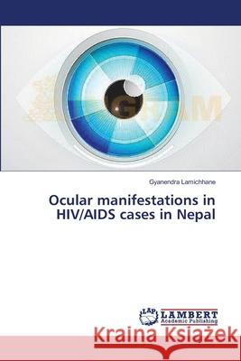 Ocular manifestations in HIV/AIDS cases in Nepal Lamichhane, Gyanendra 9783659560958 LAP Lambert Academic Publishing - książka