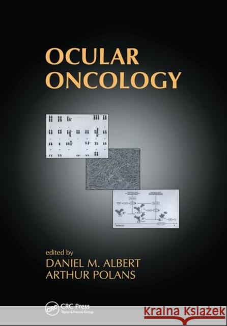 Ocular Oncology Daniel M. Albert Arthur Polans 9780367446673 CRC Press - książka