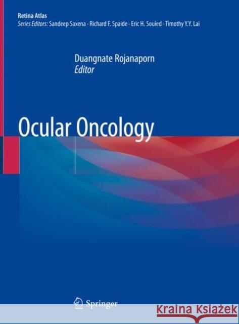 Ocular Oncology Duangnate Rojanaporn 9789811323355 Springer - książka