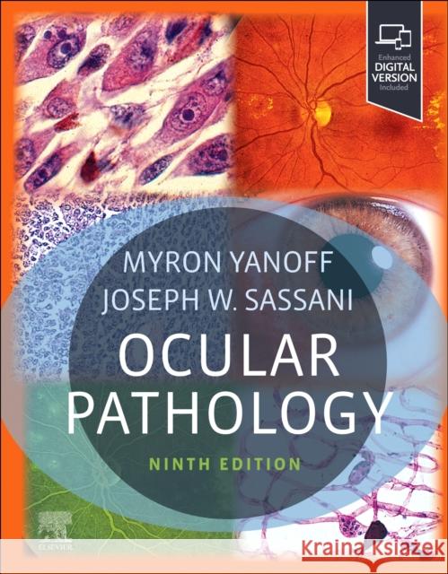 Ocular Pathology Myron Yanoff Joseph W. Sassani 9780323878227 Elsevier - książka