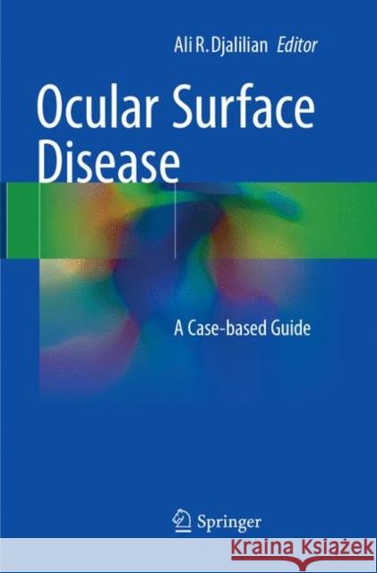Ocular Surface Disease: A Case-Based Guide Djalilian, Ali R. 9783319792217 Springer - książka