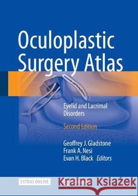 Oculoplastic Surgery Atlas: Eyelid and Lacrimal Disorders Gladstone, Geoffrey J. 9783319673332 Springer - książka