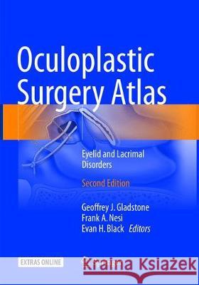 Oculoplastic Surgery Atlas: Eyelid and Lacrimal Disorders Gladstone, Geoffrey J. 9783319884141 Springer - książka