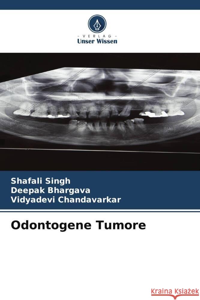 Odontogene Tumore Singh, Shafali, Bhargava, Deepak, Chandavarkar, Vidyadevi 9786206297871 Verlag Unser Wissen - książka