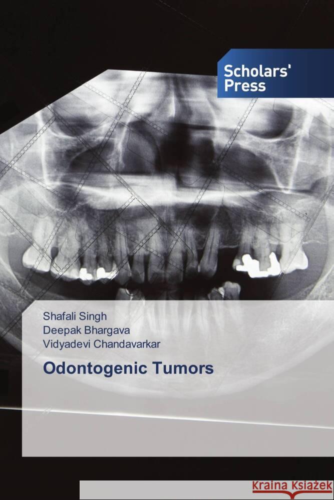 Odontogenic Tumors Singh, Shafali, Bhargava, Deepak, Chandavarkar, Vidyadevi 9786205524411 Scholars' Press - książka