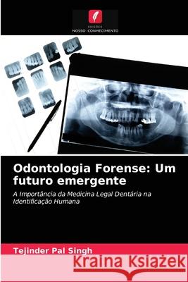 Odontologia Forense: Um futuro emergente Tejinder Pal Singh 9786203401790 Edicoes Nosso Conhecimento - książka