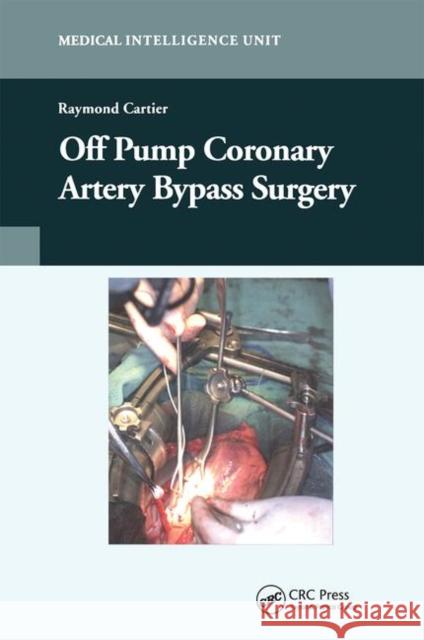 Off-Pump Coronary Artery Bypass Surgery Raymond Cartier   9780367446512 CRC Press - książka