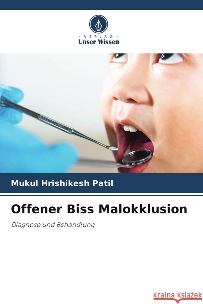 Offener Biss Malokklusion Patil, Mukul Hrishikesh 9786206432890 Verlag Unser Wissen - książka