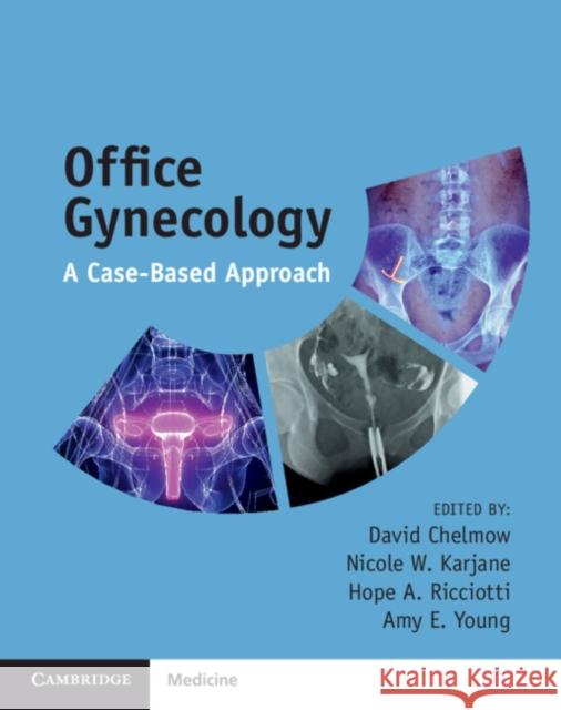 Office Gynecology: A Case-Based Approach David Chelmow Nicole Karjane Hope Ricciotti 9781108400220 Cambridge University Press - książka