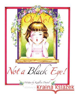 Oh No! Not a Black Eye! Kathleen Dautel 9781545671818 Xulon Press - książka