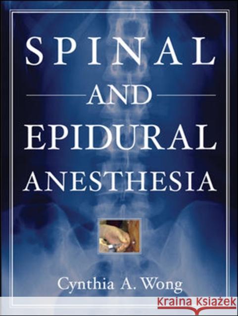 Spinal and Epidural Anesthesia