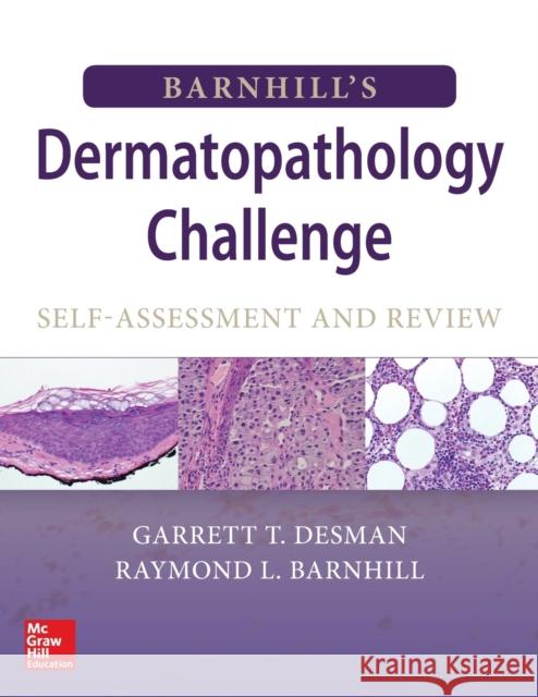 Barnhill's Dermatopathology Challenge: Self-Assessment & Review