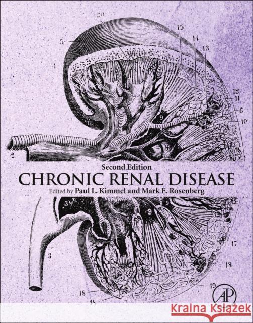 Chronic Renal Disease