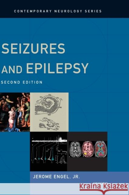 Seizures and Epilepsy