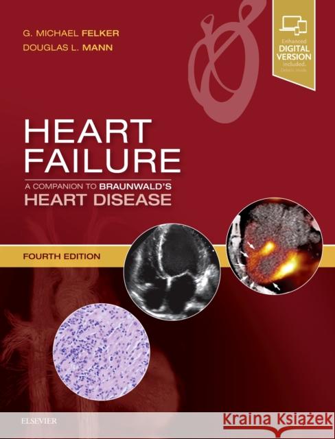 Heart Failure: A Companion to Braunwald's Heart Disease