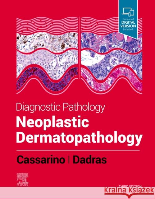 Diagnostic Pathology: Neoplastic Dermatopathology