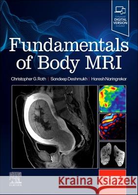 Fundamentals of Body MRI