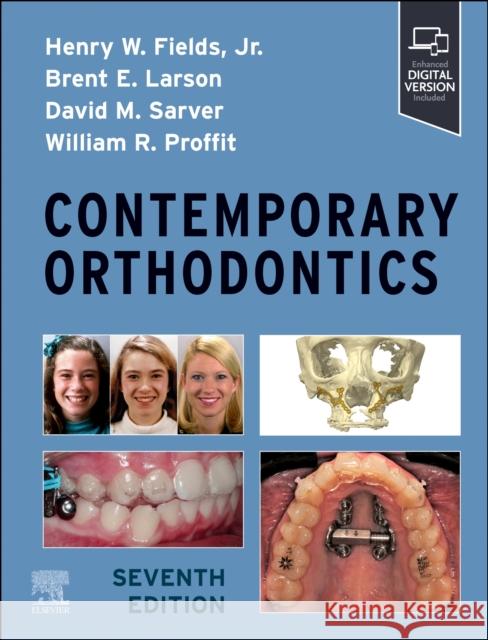 Contemporary Orthodontics