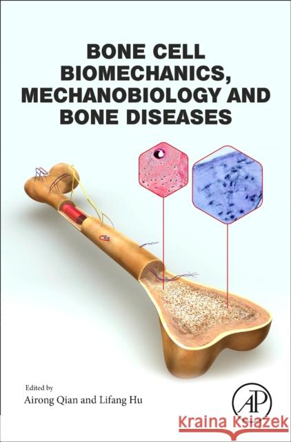 Bone Cell Biomechanics, Mechanobiology and Bone Diseases