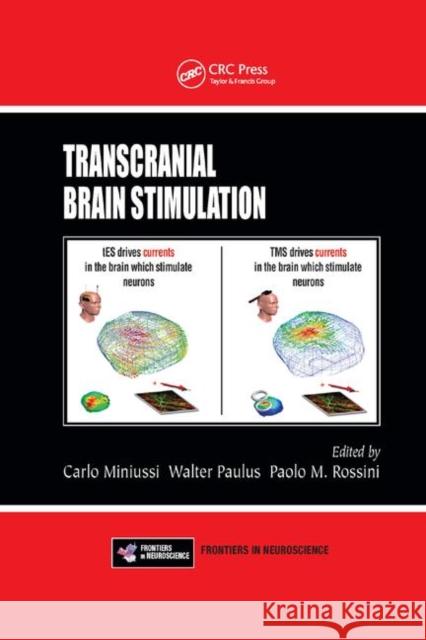 Transcranial Brain Stimulation