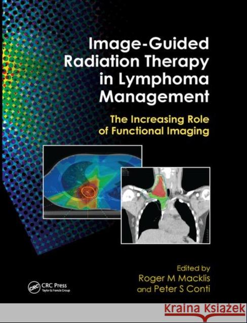 Image-Guided Radiation Therapy in Lymphoma Management: The Increasing Role of Functional Imaging