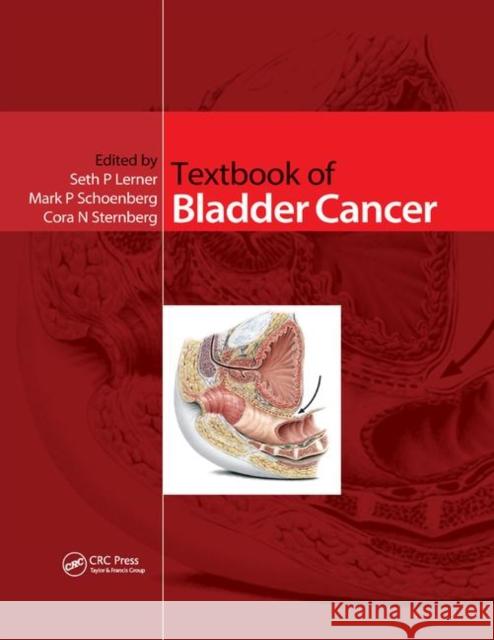 Textbook of Bladder Cancer