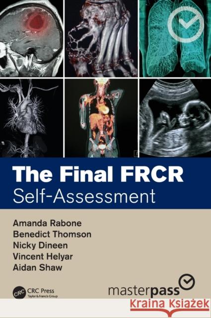 The Final Frcr: Self-Assessment