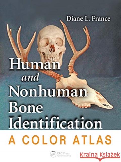 Human and Nonhuman Bone Identification: A Color Atlas