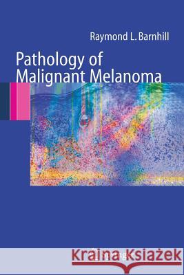 Pathology of Malignant Melanoma