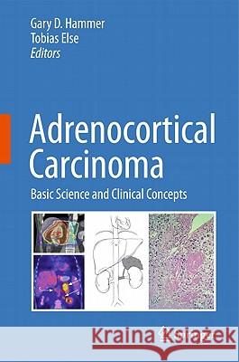 Adrenocortical Carcinoma: Basic Science and Clinical Concepts