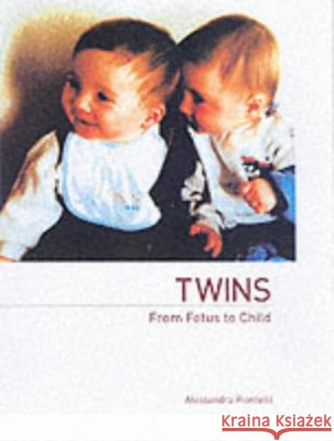 Twins - From Fetus to Child