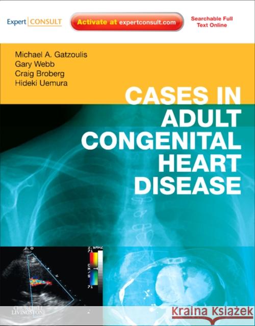 Cases in Adult Congenital Heart Disease - Expert Consult: Online and Print: Atlas [With Access Code]