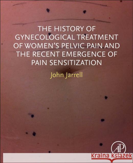 The History of Gynecological Treatment of Women’s Pelvic Pain and the Recent Emergence of Pain Sensitization