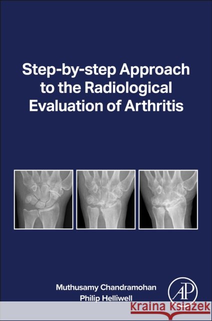 Radiological Eval of Arthritis