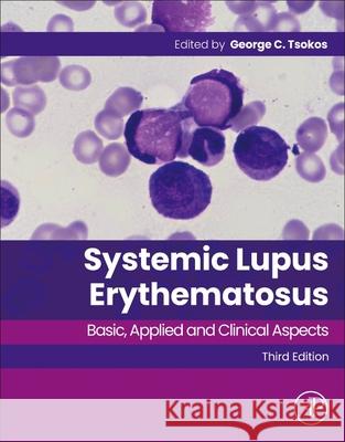 Systemic Lupus Erythematosus: Basic, Applied and Clinical Aspects