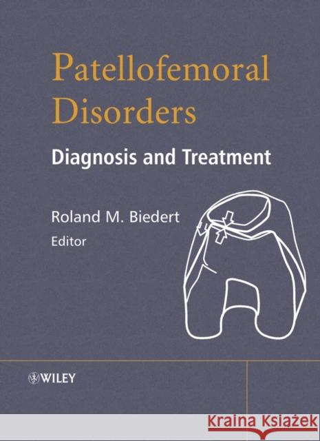 Patellofemoral Disorders: Diagnosis and Treatment