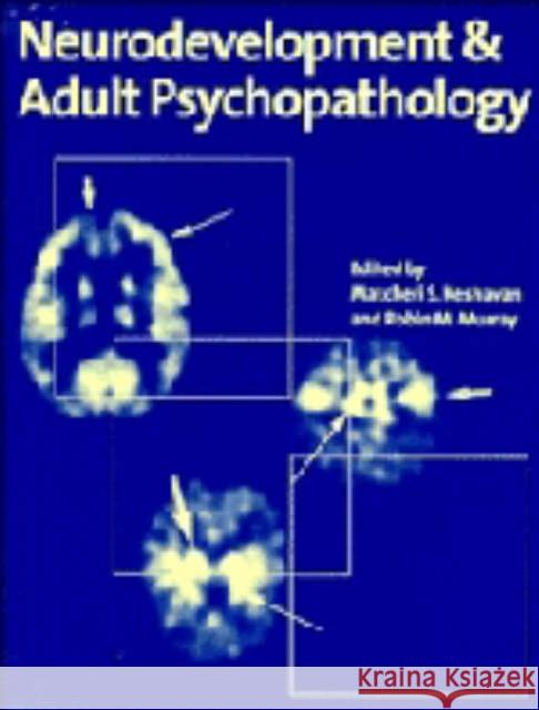 Neurodevt & Adult Psychopathology