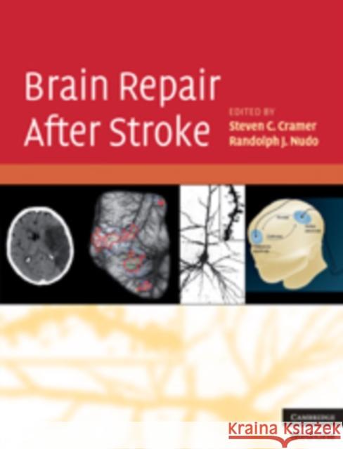 Brain Repair After Stroke